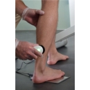 Aplikacja elektrody czynnej i płyty neutralnej podczas zabiegu Thermo TK Zimmer – łydka pacjenta.